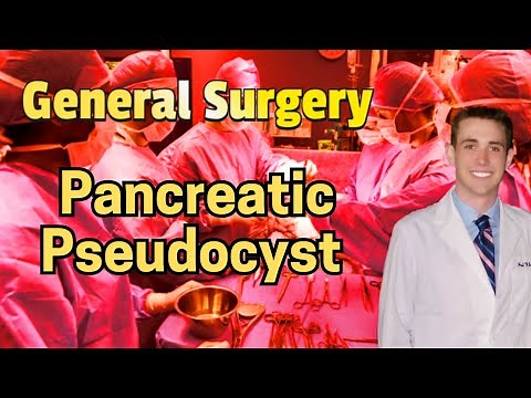 Pancreatic Pseudocyst (updated 2024) - CRASH! Medical Review Series