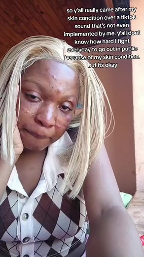 #stitch with @Pennelope Neo🥀 #greenscreen don't worry your acne is gone #soothingskincare #hydrationskincare #acneset