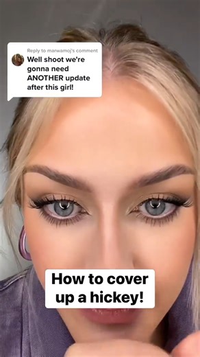 16K views · 339 reactions | juvenile behavior but it’s a really easy fix #hickey #colourcorrection #makeuptutorial #beginnersmakeup #makeupartist #reels | Makeup by Katie | Facebook