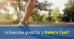 Is Exercise good for a Baker’s Cyst? - OSMO Patch US