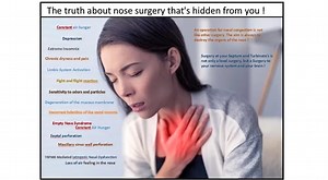 Empty Nose Syndrome: a scientific explanation. (Lecture about complications from nose surgery)
