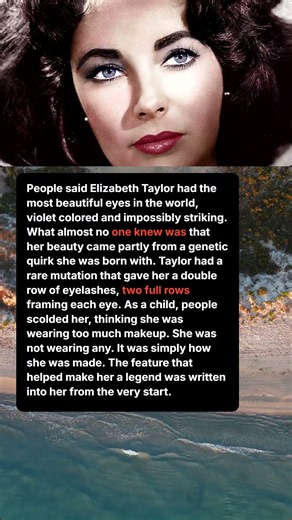 Elizabeth Taylor Was Born With a Rare Genetic Trait