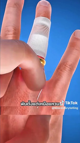 วิธีเอาแหวนออกจากนิ้วบวมๆ😬#fyp #เรื่องเล่า #เรื่องจริง #สาระความรู้ #ฟีดดดシ Cr.Zack D Flims