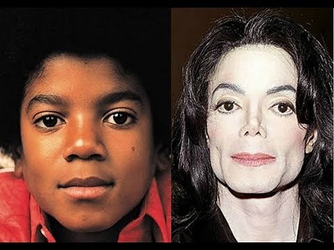 Rinoplastia do Michael Jackson (Michael Jackson Nosejob)