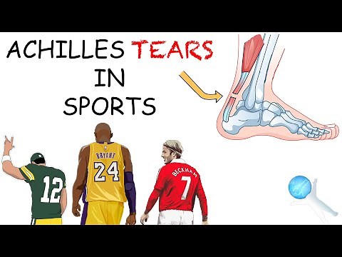 Achilles Tendon Rupture in Sports - Causes, Surgery, Rehab