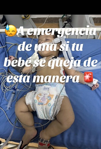 Virus Sincitial en Bebés: Tos, Flema y Fiebre