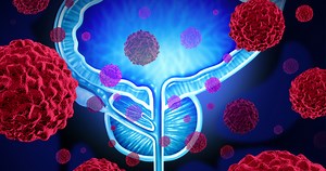 Evaluating Drug Regimens for High-Risk Prostate Cancer - News Center