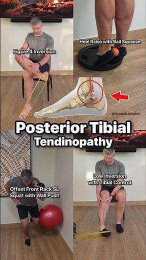 Posterior Tibial Tendinopathy - Rehab Exercises
