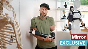 Dad feels like 'The Terminator' after getting world's first fully bionic arm