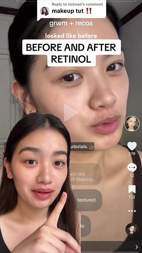 See the Transformation: Before and After Retinol Journey