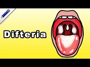 La Difteria Síntomas Contagio Tratamiento Vacuna