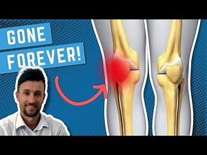 How to Permanently Fix Patellofemoral Joint Pain Syndrome (PFPS)
