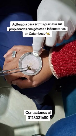 Apiterapia para Artritis en Catambuco: Beneficios Clave