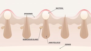 Celluma PRO | LED Light Tharapy - Large 3Mode Panel for Wrinkles, Acne, and Pain