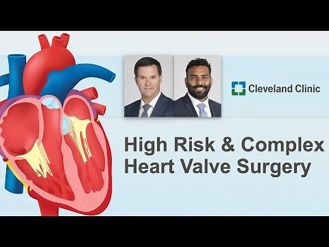 Surgeon Roundtable: High Risk & Complex Heart Valve Surgery with Dr. Soltesz & Dr. Zaki