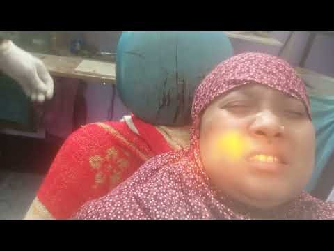 LOWER LEFT THIRD MOLAR PAIN | EMERGENCY TEMPORARY TREATMENT | SWELLING & SENSITIVITY RELIEF