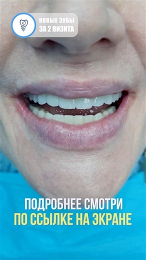 Restored a charming and alluring smile for our patient. Dental implantation.