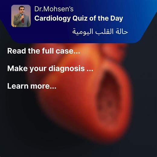 🫀 𝐂𝐚𝐫𝐝𝐢𝐨𝐥𝐨𝐠𝐲 𝐐𝐮𝐢𝐳 𝐨𝐟 𝐭𝐡𝐞 𝐃𝐚𝐲! Smoker with emphysema, progressive oedema and hypoxia with right parasternal heave; cor pulmonale likely? Cast your vote on MedShr:🔗 https://sbee.link/yvcn6haf9d #Cardiology #Cardiofacebook #Medfacebook #foamed #MedEd #Medical #medstudentlife #doctor #healthcareworker #healthcare #Wellness #medstudent #nhsdoctors #ukdoctors #MedEd #med #medicine #mednotes #hospitals | MedShr