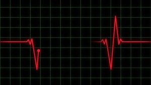 Heart Rate Monitor Ecg Loop Animation Stock Footage Video (100% Royalty-free) 1104822029 | Shutterstock