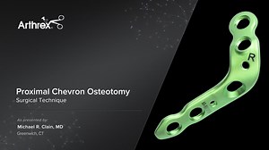 Proximal Chevron Osteotomy