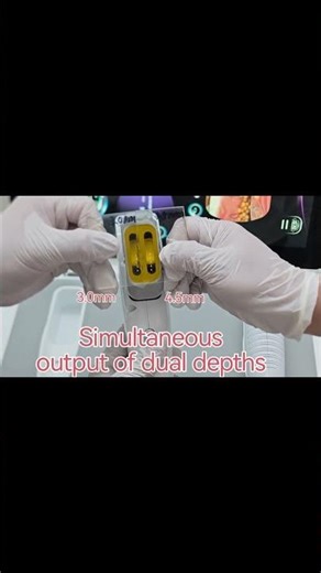 How Clinics Operate HIFU Treatment Machines