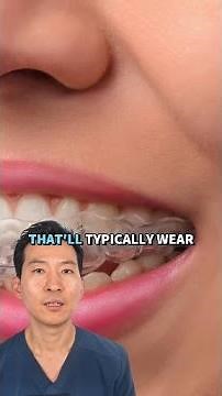 Retainers 101 Dont Skip This After Braces! #shorts