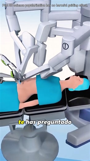 How Gallbladder Removal Surgery is Performed? #foryou #3danimation #hospital #doctor #didyouknow