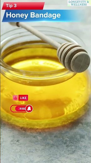 How To Treat Minor Burn