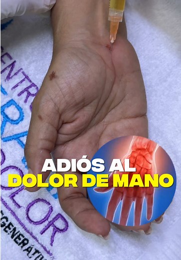 Tratamiento Regenerativo para el Dolor de Mano