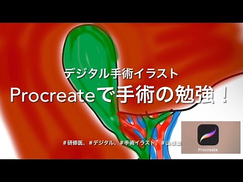Procreate初心者が手術イラストに挑戦！手術の勉強にもなります！！