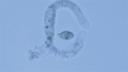 Fascinating moment amoeba consumes single-celled organism