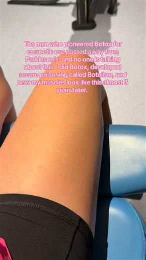 I also know someone who got ALS from Botox as well. Dr James Alastair who pioneered Botox for cosmetic use passed away from a battle with Parkinson’s in 2024. Did he “revolutionize” the cosmetic industry? No. Was this at the expense of his life? Yes. In the largest post marketing study done to date in 2025 on REAL people years after toxin use, there were rates of: 3.3% having muscle weakness 2.5% having nerve damage 2.3% having muscle atrophy. There are also studies linking other neurotoxins to 