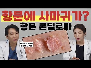 항문에 사마귀가? 항문 콘딜로마 치료방법(ft.대장항문외과전문의와 산부인과 전문의가 알려주는 항문 콘딜로마)