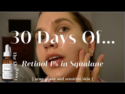 I Used The Ordinary 1% Retinol in Squalane For 30 Days | Acne Scarring Before and After