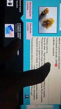 Renal stone quick review "Calcium oxalate "🤓