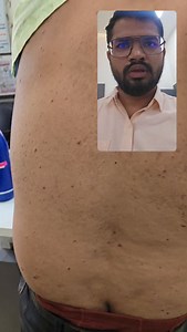 Learn from such live cases only on my youtube channel.. homeomonk. Subscribe now | Dr Raj Bondre Homeopathy Coach