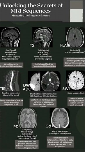 some basics of MRI sequences. Credit: Dr Robert Mariasi