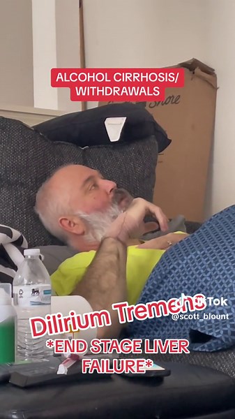 Understanding Alcoholic Cirrhosis and Its Effects