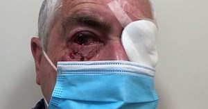 'Blood was dripping': Man flown to hospital after vicious magpie attack