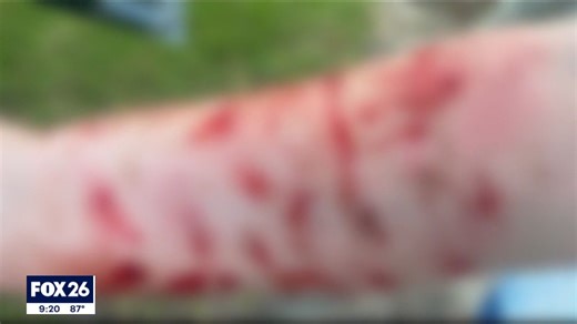 WATCH: A Texas woman says she's thankful to be alive after a snake fell from the sky, wrapped around her arm, and started trying to bite her face. This, as a hawk tried repeatedly to rip the snake off her harm. https://www.fox26houston.com/news/texas-woman-survives-simultaneous-attacks-from-a-snake-and-hawk Photographer: Chandler Watson | Matthew Seedorff