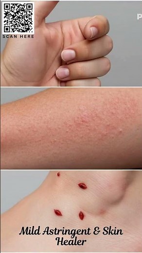Zinc Oxide IP Benefits | Best Sunscreen, Skincare & Everyday Uses #adpl