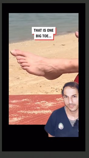 6.5K views · 7 comments | Toe-tally awesome #toe #macrodactyly #gigantism | Nick Pappas, MD | Facebook