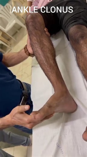 Demonstration of Ankle Clonus and Patellar Clonus
