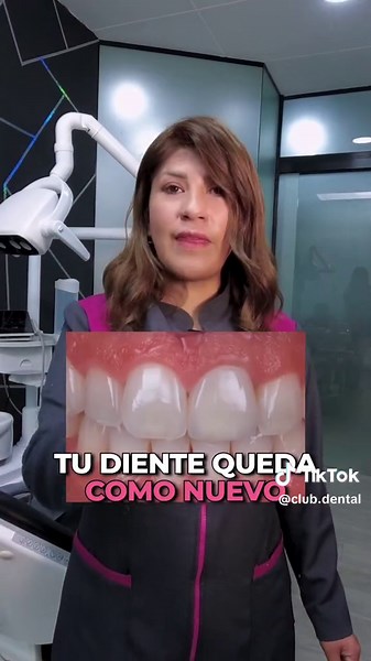 Tratamiento de conducto: ¡Recupera tu diente roto con un perno y corona!