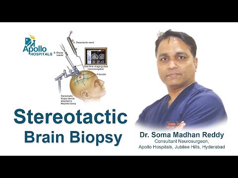 Stereotactic Brain Biopsy | Dr S Madhan Reddy, Consultant Neurosurgeon | Apollo Hospitals Hyderabad