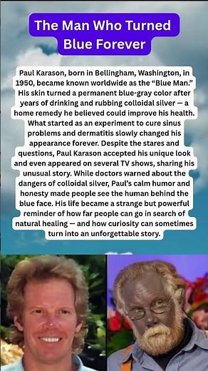 America’s Blue Man | The Man Who Turned Blue Forever #shorts #usa #usatidbits #medicalmystery