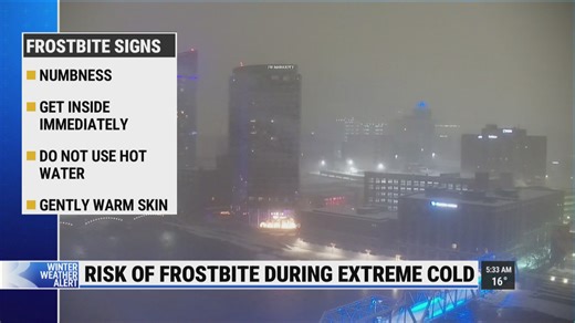 Risk of frostbite high amid extreme cold