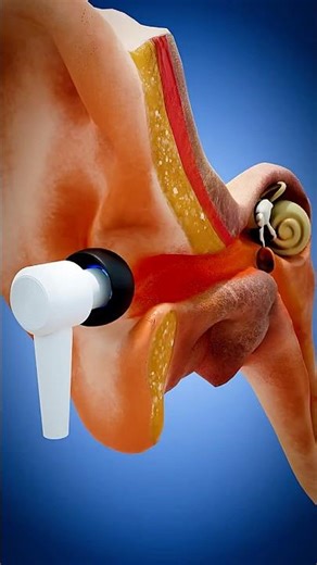 [URGENT] Earbud Dangers: How Loud Music DESTROYS Your Hearing! 🎧💥