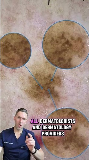 Without this tool, your skin exam is missing cancer