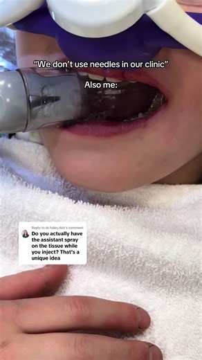 Replying to @dr.haley.dds they’ll never know! I also use this technique for adults as well! #yycdentist #airdriedentist #dentistry #kidsdentist #familydentist #sedationdentistry #dentalstudent #dentalhygienist #dentalanxiety #MomsofTikTok #southairdriesmiles #yyccalgary #fyp @Zyris Isolite